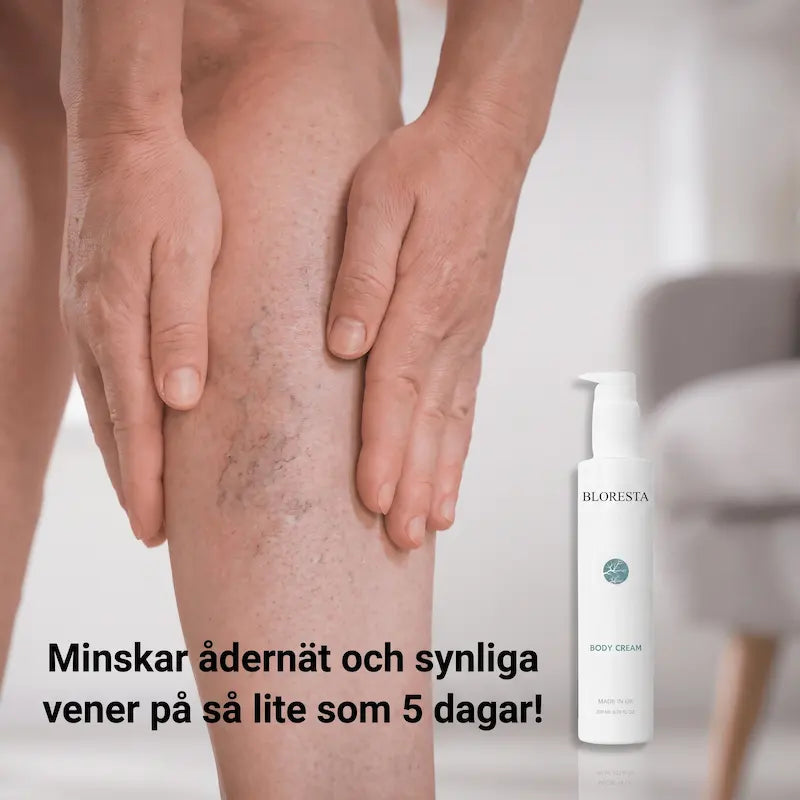Bloresta™ – Minska synliga åderbråck på 5 dagar